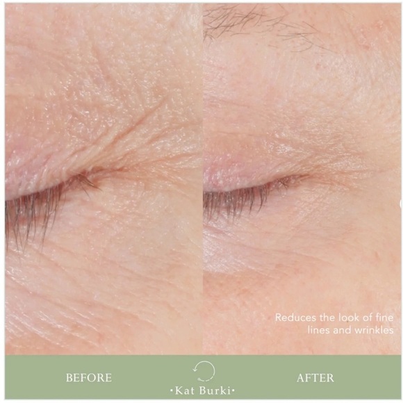 Kat Burki Reversal Lift & Fill Form Control Marine Collagen Gel 30ml BRAND NEW - Picture 4 of 8